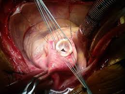 (heartsurgeon.co.in)