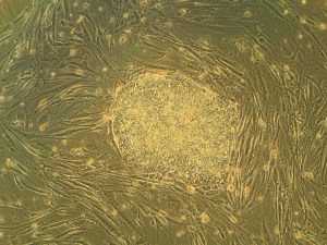 An embryonic stem cell (Wikipedia)